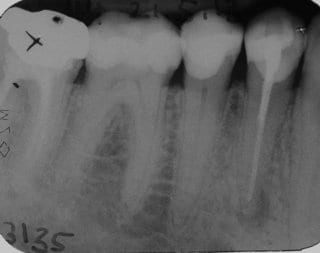 Fig. 8: Dental film of the dentist