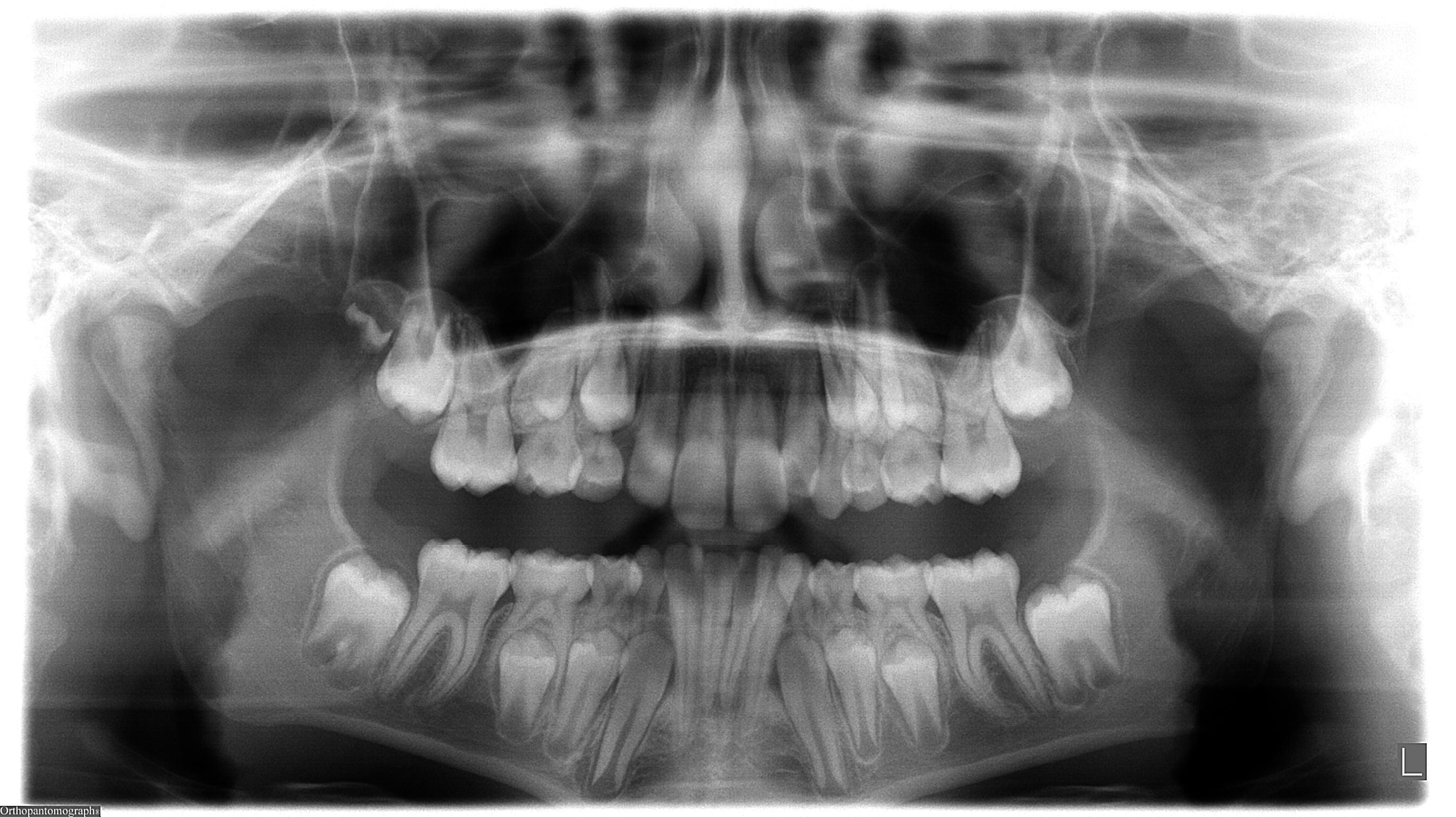 Ortodoncia ‒ caso clínico 1 | MORITA