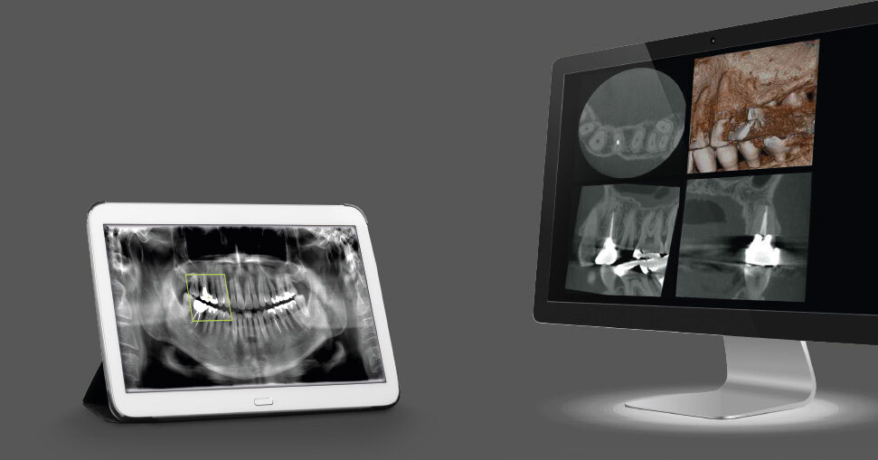 Röntgen Aufnahme betrachten Bildschirm