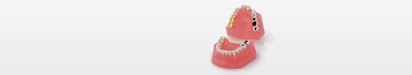 Caries and Dental Restorations Models
