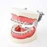 Modelli ortodontici