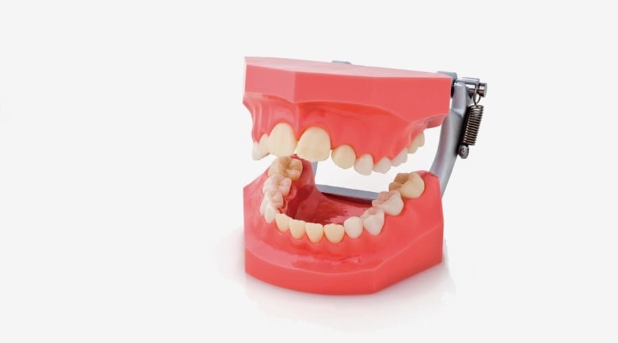Vente de Modèle de dents d'enfants Modèle d'étude de démonstration en  pathologie pédiatrique 4002 en ligne 