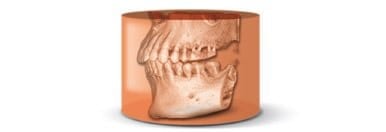 Fachkunde für die dentale DVT-Diagnostik nach Röntgenverordnung
