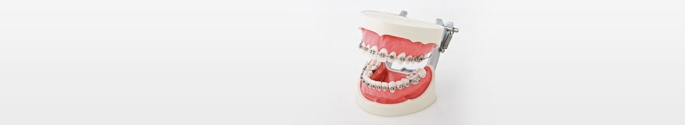 Modelos de ortodoncia